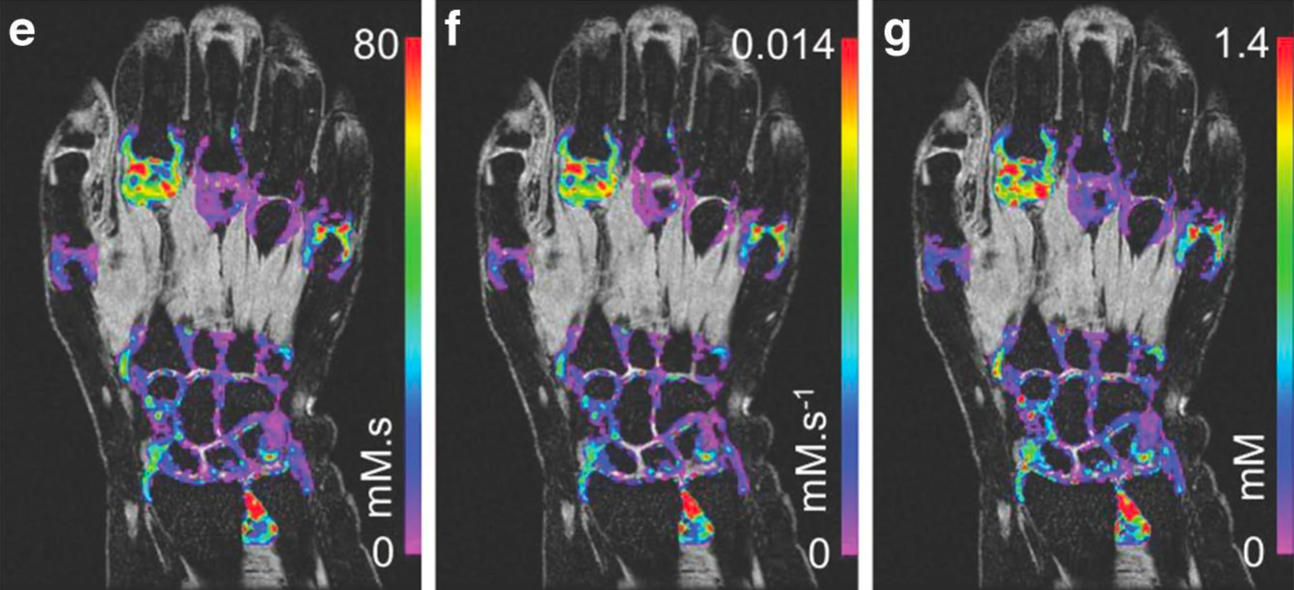 Ktrans change in inflamed joints